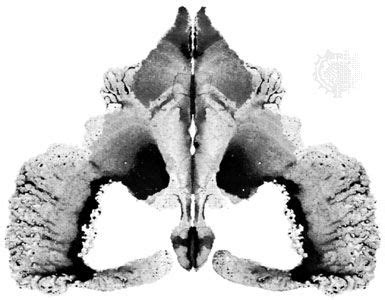 psychology ink spot tests.
